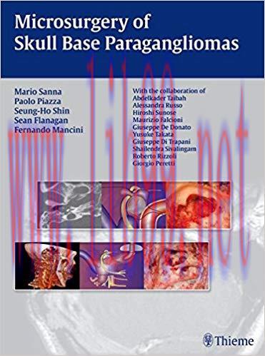 [PDF]Microsurgery of Skull Base Paragangliomas