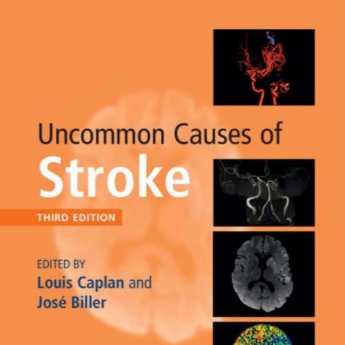 Uncommon Causes of Stroke 3rd Edition - Wei Zhi