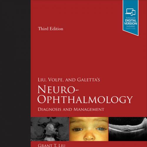 Liu, Volpe, and Galetta's Neuro-Ophthalmology_ Diagnosis and Management, 3e
