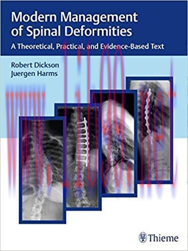[AME]Modern Management of Spinal Deformities: A Theoretical, Practical, and Evidence-based Text...