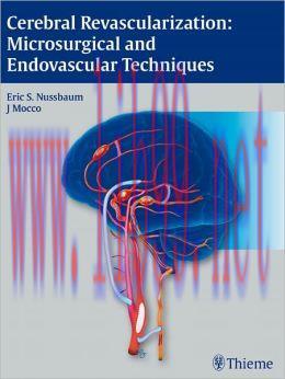[AME]Cerebral Revascularization: Microsurgical and Endovascular Techniques (ORIGINAL PDF from_ ...