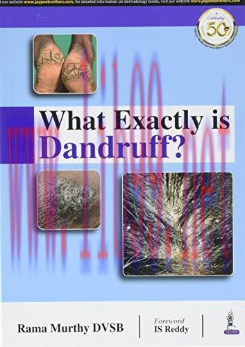 [AME]What Exactly is Dandruff (Original PDF)