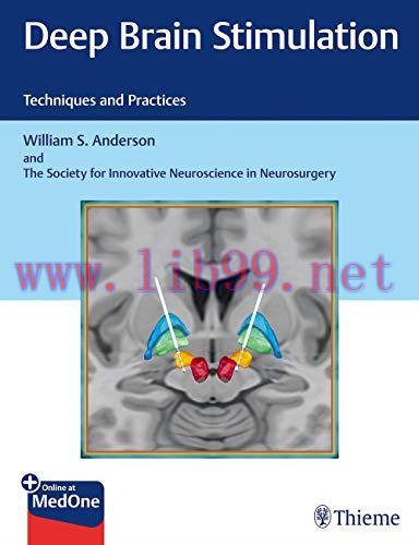 [AME]Deep Brain Stimulation: Techniques and Practices (Original PDF)