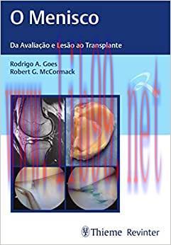 [AME]O Menisco: Da Avalia&ccedil;&atilde;o e Les&atilde;o ao Transplante, 1st edition (Original PDF)