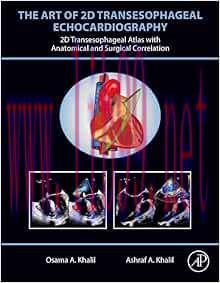 [AME]The Art of 2D Transesophageal Echocardiography: 2D Transesophageal Atlas with Anatomical a...