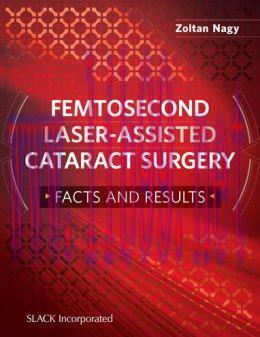 [AME]Femtosecond Laser-Assisted Catarac Surgery: Facts and Results (ORIGINAL PDF from_ Publishe...