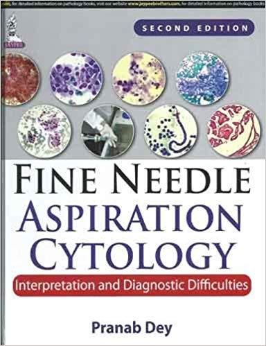 Fine Needle Aspiration Cytology Interpretation and Diagnostic Difficulties, 2E