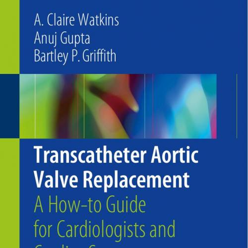 Transcatheter Aortic Valve Replacement