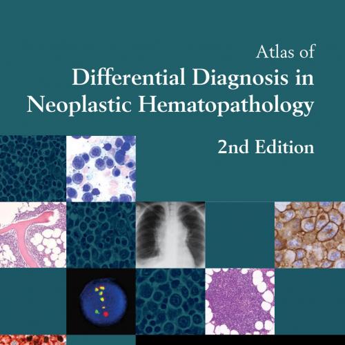 Atlas of Differential Diagnosis in Neoplastic Hematopathology, 2nd edition - Wei Zhi
