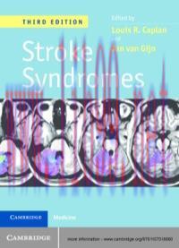 [AME]Stroke Syndromes, 3e (Original PDF)