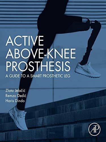 Active Above-Knee Prosthesis A Guide to a Smart Prosthetic Leg