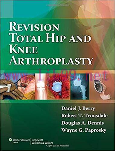 [PDF]Revision Total Hip and Knee Arthroplasty +CHM版