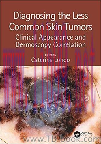Diagnosing the Less Common Skin Tumors: Clinical Appearance and Dermoscopy Correlation 1st Edit...