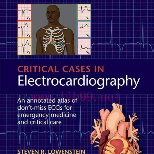 [AME]Critical Cases in Electrocardiography: An Annotated Atlas of Don't-Miss ECGs for Emergency...