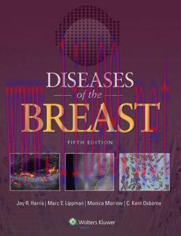 [AME]Diseases of the Breast 5e (ORIGINAL PDF from_ Publisher)