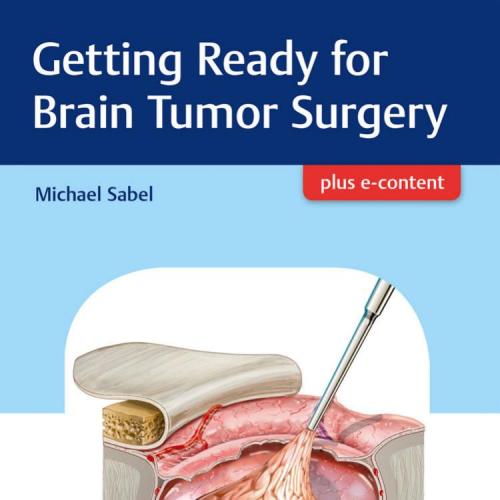 Getting Ready for Brain Tumor Surgery