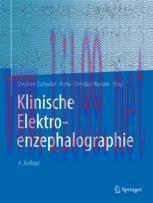 [PDF]Klinische Elektroenzephalographie