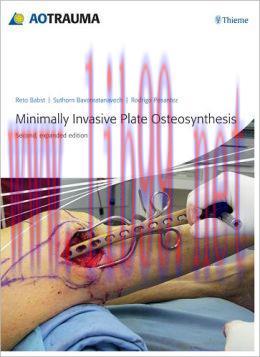 [AME]Minimally Invasive Plate Osteosynthesis (MIPO) (ORIGINAL PDF from_ Publisher)