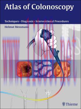 [AME]Atlas of Colonoscopy: Examination Techniques and Diagnosis
