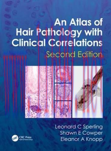 [AME]An Atlas of Hair Pathology with Clinical Correlations, Second Edition