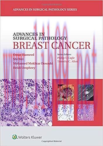 [CHM]Advances in Surgical Pathology - Breast Cancer, 1st Edition