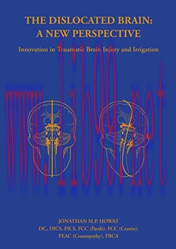 [AME]The Dislocated Brain: A New Perspective (EPUB + Converted PDF)