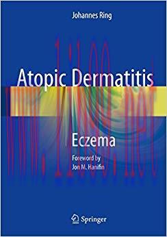 (PDF)Atopic Dermatitis: Eczema 1st ed. 2016 Edition