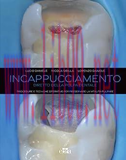 [AME]Incappucciamento diretto della polpa dentale: Procedure e tecniche operative per preservar...