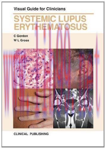 [AME]Systemic Lupus Erythematosus: Visual Guide for Clinicians (Original PDF)