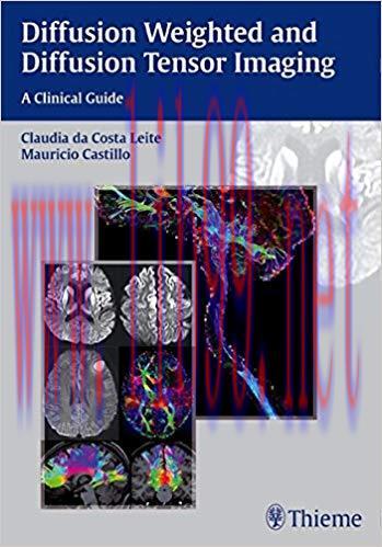 [PDF]Diffusion Weighted and Diffusion Tensor Imaging