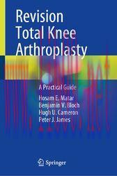 [AME]Revision Total Knee Arthroplasty : A Practical Guide (Original PDF)