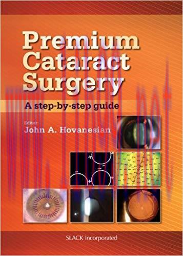 [PDF]Premium Cataract Surgery