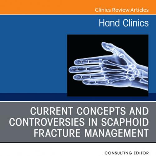 Current Concepts and Controversies in Scaphoid Fracture Management