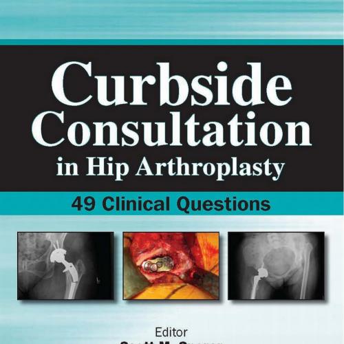 Curbside Consultation in Hip Arthroplasty-49 Clinical Questions