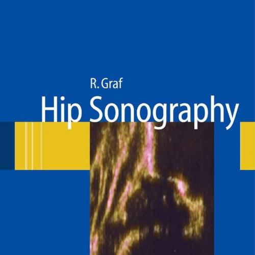 Hip Sonography Diagnosis and Management of Infant Hip Dysplasia