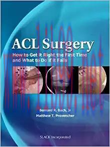[PDF]ACL Surgery How to Get it Right the First Time and What to Do