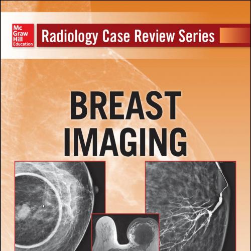 Radioliogy Case Review Series Breast Imaging