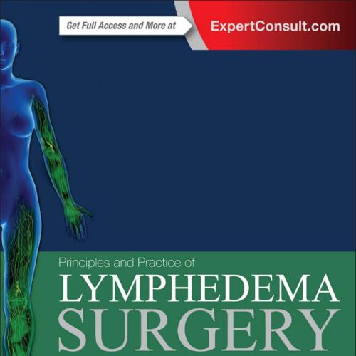 Principles and Practice of Lymphedema Surgery
