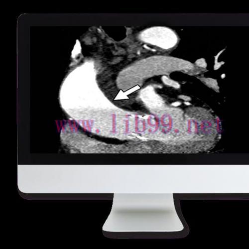 [AME]Highlights in Thoracic and Cardiovascular Imaging 2019 (CME VIDEOS)