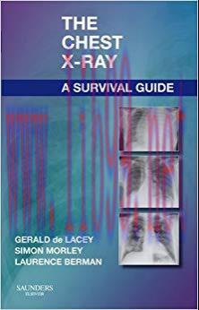 (PDF)The Chest X-Ray: A Survival Guide 1st Edition