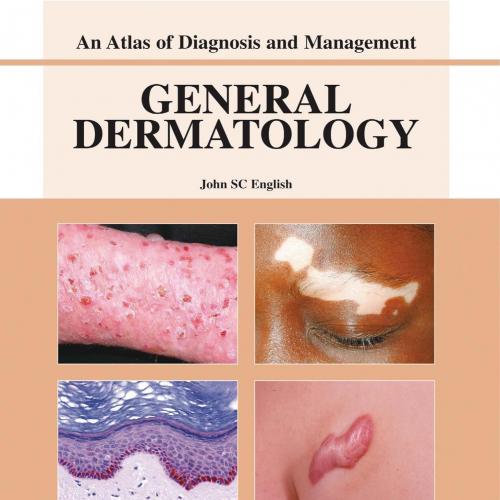 General Dermatology-An Atlas of Investigation and Managemen