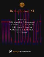 [PDF]Brain Edema XI: Proceedings of the 11th International Symposium, Newcastle-upon-Tyne, Unit...