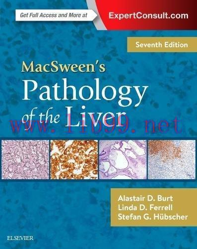 [AME]MacSween's Pathology of the Liver, 7th Edition (PDF)