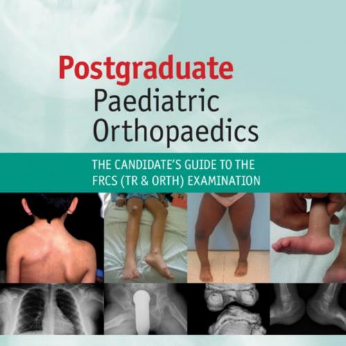Postgraduate Paediatric Orthopaedics-The Candidate's Guide to the FRCS (Tr and Orth) Examinatio...