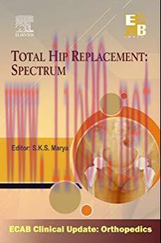 [PDF]Total Hip Replacement - Spectrum