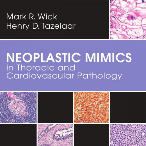 Neoplastic Mimics in Thoracic and Cardiovascular Pathology(Original PDF)