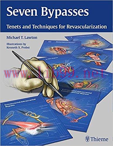 [AME]Seven Bypasses: Tenets and Techniques for Revascularization 1st Edition (Original PDF)