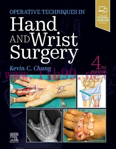 [AME]Operative Techniques: Hand and Wrist Surgery, 4th Edition (EPUB3 + Converted PDF)