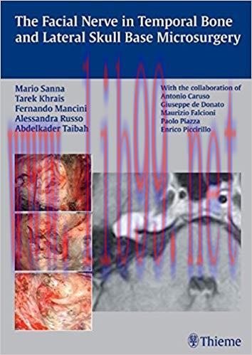 [PDF]The Facial Nerve in Temporal Bone and Lateral Skull Base Microsurgery