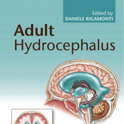 Adult Hydrocephalus - Daniele Rigamonti